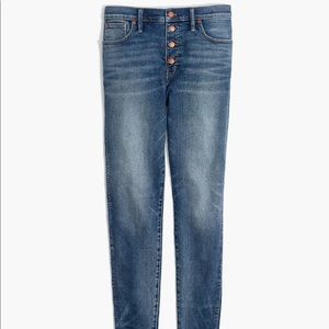 Madewell Button Fly Jeans